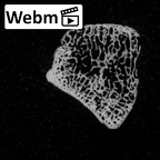 DV62 Homo sapiens scaphoid left ct stack movie