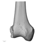 DV13-103 Homo sapiens femur right distal anterior
