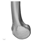 DV13-103 Homo sapiens femur right distal medial