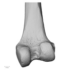 DV13-103 H. sapiens femur right distal