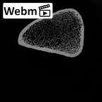 DV13-103 Homo sapiens femur right distal ct stack movie