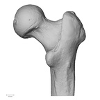 DV13-103 H. sapiens femur right proximal