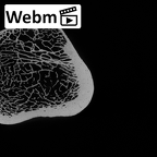 DV13-103 Homo sapiens femur right proximal ct stack movie