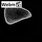 DV13-104 Homo sapiens femur left distal ct stack movie
