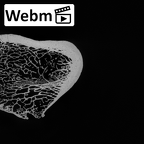 DV13-104 Homo sapiens femur left proximal ct stack movie