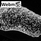 DV13-105 Homo sapiens patella right ct stack movie