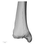 DV13-107 Homo sapiens tibia right distal anterior