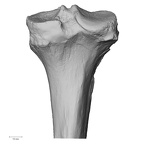 DV13-107 H. sapiens tibia right proximal