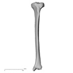 DV13-108 Homo sapiens tibia left anterior