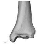DV13-108 Homo sapiens tibia left distal anterior