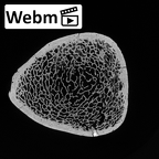 DV13-108 Homo sapiens tibia left distal ct stack movie