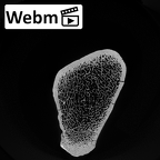 DV13-108 Homo sapiens tibia left proximal ct stack movie