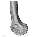 DV14-126 Homo sapiens femur right distal medial
