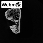 DV14-126 Homo sapiens femur right distal ct stack movie