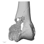 DV14-127 Homo sapiens femur left distal anterior