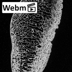 DV14-128 Homo sapiens patella right ct stack movie