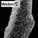 DV14-129 Homo sapiens patella left ct stack movie