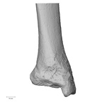 DV14-130 Homo sapiens tibia right distal anterior
