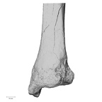DV14-130 Homo sapiens tibia right distal posterior