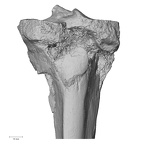 DV14-130 H. sapiens tibia right proximal