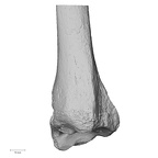 DV14-131 H. sapiens tibia left distal