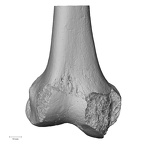 DV15-122 Homo sapiens femur right distal anterior