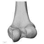 DV15-122 H. sapiens femur right distal