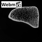 DV15-122 Homo sapiens femur right distal ct stack movie