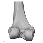 DV15-123 Homo sapiens femur left distal posterior