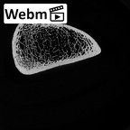 DV15-123 Homo sapiens femur left distal ct stack movie