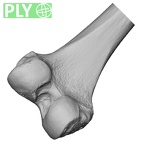 DV15-123 Homo sapiens femur left distal ply