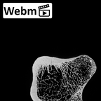 DV15-123 Homo sapiens femur left proximal ct stack movie