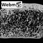 DV15-124 Homo sapiens patella right ct stack movie