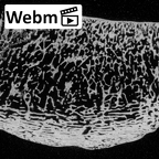 DV15-125 Homo sapiens patella left ct stack movie
