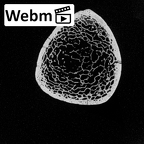 DV15-126 Homo sapiens tibia right distal ct stack movie