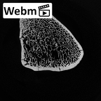 DV15-126 Homo sapiens tibia right proximal ct stack movie