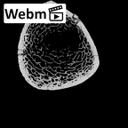 DV15-127 Homo sapiens tibia left distal ct stack movie