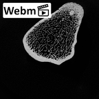 DV15-127 Homo sapiens tibia left proximal ct stack movie