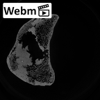 DV16-114 Homo sapiens femur left distal ct stack movie