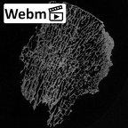 DV16-116 Homo sapiens femur proximal ct stack movie