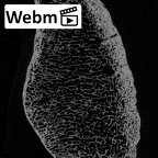 DV16-118 Homo sapiens patella left ct stack movie