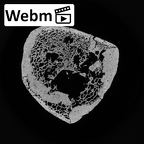DV16-119 Homo sapiens tibia right distal ct stack movie