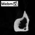 DV16-121 Homo sapiens fibula right ct stack movie