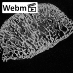 DV20 Homo sapiens femur proximal ct stack movie