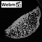 DV21 Homo sapiens femur proximal ct stack movie