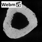 DV40 Homo sapiens femur right ct stack movie
