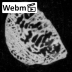 DV15-147 Homo sapiens sesamoid ct stack movie