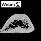 DV13-84 Homo sapiens humerus right distal ct stack movie