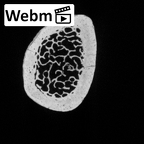 DV13-86 Homo sapiens ulna right distal ct stack movie