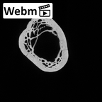 DV13-89 Homo sapiens radius left proximal ct stack movie